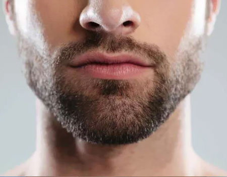 Beard Transplant